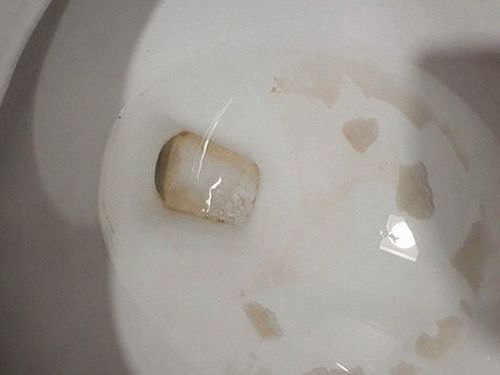 개화동 하수구막힘 배수 상태와 하부장 주변의 누수 여부를 확인하는 장면